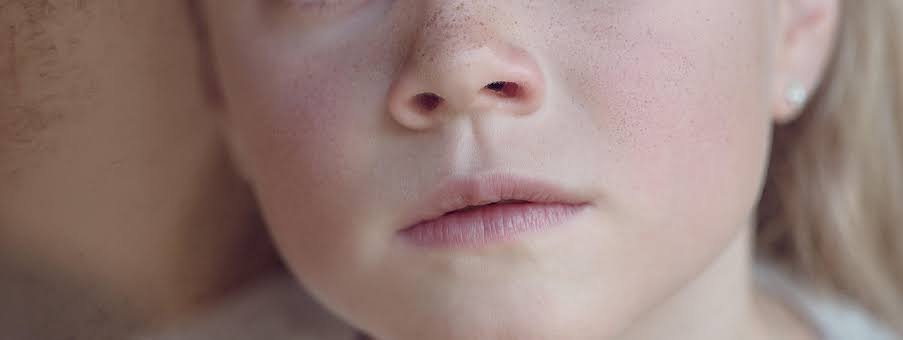 why-is-my-nose-leaking-yellow-fluid?-the-answers-you’re-looking-for